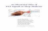 An Illustrated Atlas of PAT Signals in Sleep Medicinewatchpat.weebly.com/uploads/6/8/3/6/6836528/an_illustrated_atlas_of... · An Illustrated Atlas of PAT Signals - 2 - ©Itamar-Medical
