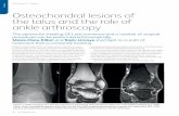 Osteochondral lesions of the talus and the role of …...24 Feature OPN issue 171 Feature Osteochondral lesions of the talus and the role of ankle arthroscopy The options for treating