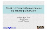Classification histomoléculaire du cancer pulmonairesplf.fr/wp-content/uploads/2018/10/S4-2.pdf · – Proximal, bas grade, cellule épithéliale CK7+ et myoépithéliale p63+, évolution
