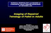 Imaging of Repaired Tetralogy of Fallot in Adults...Imaging of Repaired Tetralogy of Fallot in Adults . SURGICAL MORPHOLOGY and IMAGING of CONGENITAL HEART DISEASE WORKSHOP . 22. nd.