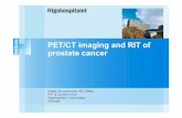 PET-CT imaging and RIT of prostate cancer · Prostate cancer •Prostate cancer is the most common malignancy in men •Imaging modalities are important • Staging and restaging