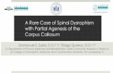 A Rare Case of Spinal Dysraphism with Partial …...A Rare Case of Spinal Dysraphism with Partial Agenesis of the Corpus Callosum Emmanuel S. Sakla, D.O.(1,2), Thiago Queiroz, D.O.(1,2)