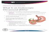 ENDOSCOPIC ULTRASOUND (EUS) What Is an Endoscopic ... · Getting ready for an upper EUS is not the same as getting ready for a lower EUS. Be sure to ask your doctor which test you
