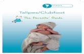 Talipes/Clubfoot - St Richard's Hospital...The term CTEV is rarely used by families, it is usually diagnosed as ‘talipes’ but is commonly referred to as Clubfoot. It may affect