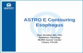 ASTRO E Contouring Esophagus - cmcgc.com for Esophageal... · ASTRO E Contouring Esophagus . Highlights 1. Anatomy review Nodes in mediastinum and abdomen . 2. Motion considerations: