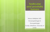 Testicular and prostatic tumors · highly malignant form of testicular tumor. its “pure” form is rare, constituting less than 1% of all germ cell tumors -This neoplasm can also