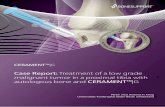 CERAMENT™|G - Bonesupport...with a giant cell tumor (GCT) in the proximal left tibia, so surgical treatment was planned accordingly (Figs. 1 & 2). TREATMENT Rurettage of the tumor,