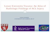 Lower Extremity Trauma: An Atlas of Radiologic Findings of ... · of its posterosuperior border is concave Alternatively, measure an angle created by lines placed parallel to the