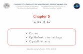 Chapter 5 (TS 34-47) - Opencourses AUTh Documents/06...Chapter 5 Skills 34-47 . Slides edited by Argyrios Tzamalis , MD, PhD, MA, FEBO ... Secondary glaucoma Retinal detachment Cataract