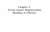 Chapter 3: Tissue repair: Regeneration, Healing, & …...healing by combine regeneration & fibrosis which follows injury to the liver cells & stroma (commonly due to alcoholism or