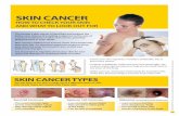 SKIN CANCER• Melanoma is the most deadly form of skin cancer. • If left untreated it can spread to other parts of the body to form new cancers. • Melanoma appears as a new spot