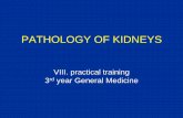 PATHOLOGY OF KIDNEYSustavpatologie.upol.cz/_data/section-1/175.pdfChronic pyelonefritis (end stage kidney, anamnesis of prostatic hypertrophy) Dilatated ureter Capsule of kidney End