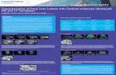 Characterisation of Focal Liver Lesions with Contrast ...ubimon.doc.ic.ac.uk/isc/public/Hounsfield2005-posters/oregan(Hounsfield).pdf · Characterisation of Focal Liver Lesions with