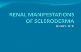 RENAL MANIFESTATIONS OF SCLERODERMA Postulated that scleroderma vasculopathy exacerbates interaction