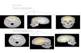 Skull Anatomy 1. Identify the highlighted bone. · 2008-11-12 · Skull Anatomy 1. Identify the highlighted bone. _____ 2. Identify the highlighted bone _____