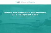 Adult orthodontic treatment of a relapsed case · 2019-01-14 · expression of root torque to prevent ﬂaring, under torqued crowns which can signiﬁcantly affect aesthetics > The