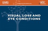 VISUAL LOSS AND EYE CONDITIONS - CECity...2 OBJECTIVES Know and understand: • The leading causes and pathophysiology of visual loss • Techniques for preventing and treating visual