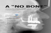 A “No BoNe” SolutioNaacd.com/proxy.php?filename=files/Dental Professionals...A “No BoNe” SolutioN Balshi/Balshi Abstract Rehabilitation of the severely atrophic maxilla presents