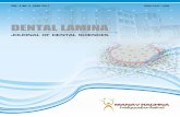 VOL. 4 NO. 2, JUNE 2017 - Manav Rachna International ... · Dental Lamina - Journal of Dental Sciences Vol. 4 No. 2, June. 2017 Ms. Shakila Mahesh, Dr. Savita Bansal, Ms. Deepthy