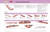 Tenderloin - Canadian Beef · Psoas major, Psoas minor, Iliacus. A deposit . of fat near the head of the tender loin is known as wedge fat. The small ribbon of meat and. connective