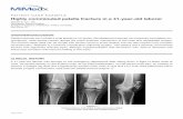 PATIENT CASE EXAMPLE Highly comminuted …stemcellrecruitment.com/wp-content/uploads/2018/05/...Patella fractures can include a wide spectrum of injuries. Nondisplaced fractures can