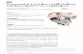 REVIEW Managementofcervicaldystoniawithbotulinum … · 2019-06-13 · mendations for eﬃcacy of diﬀerent BoNT products in CD.3 A recent meta-analysis reported that BoNT treatment