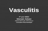 Vasculitis€¦ · Multiple myeloma Macroglobulinemia Autoimmune disease Rheumatoid arthritis . Systemic lupus Multiple emboli/, cholesterol emboli. Drug allergy . Case 2 •A 48