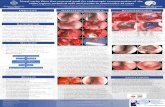 Nasal cavity floor free mucosal graft for endoscopic ...€¦ · Nasal cavity floor free mucosal graft for endoscopic reconstruction of the sellar region: technical note and results