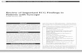 Review of Important ECG Findings in Patients with Syncope · perform in patients with syncope. Though the incidence of ECG abnormalities is quite low, urgent care clinicians must