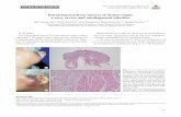 Infratemporal fossa abscess of dental origin: a rare ...€¦ · 5. Huang TT, Tseng FY, Liu TC, Hsu CJ, Chen YS. Deep neck in-fection in diabetic patients: comparison of clinical