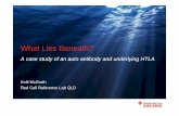 What Lies Beneath? - Blood · What Lies Beneath? A case study of an auto antibody and underlying HTLA Kelli McGrath Red Cell Reference Lab QLD