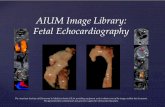 Fetal Echocardiography - Amazon Web Services€¦ · Fetal Echocardiography The American Institute of Ultrasound in Medicine thanks GE for providing equipment used to obtain some