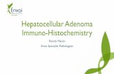 Hepatocellular Adenoma Immuno-Histochemistry · Who Classification of tumours of digestive system states: •Incidence of HCA is 3-4 per 100 000 in Europe and North America •Lower