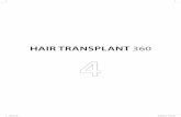 HAIR TRANSPLANT 360 4Hair Transplant 360: Follicular Unit Extraction (FUE), Volume 4 First Edition: 2016 ISBN: 978-93-5250-036-9 Printed at Jaypee-Highlights Medical Publishers Inc.