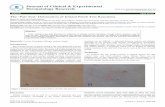 l c a l Derma Journal of Clinical & Experimental t i n o i ... · dermatitis (eg: atopic dermatitis, xerosis etc.). Besides the key factors that suggest irritant reactions, such as