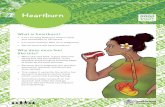 Heartburn - Queensland Children's Hospital€¦ · Heartburn What is heartburn? » It is a burning feeling in mum’s chest and sometimes in her throat » It is more common later
