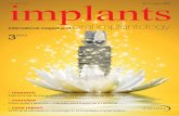 implants - epaper.zwp-online.infodosseous implant requires sufficient bone volume for complete bone coverage. Physiologically, an ideal bone grafting material should provide osteogenicity,