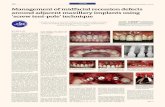 mCME Dental Tribune Middle East & Africa Edition | 1/2019 ... Vol... · Management of midfacial recession defects around adjacent maxillary implants using ‘screw tent-pole’ technique