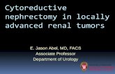 Cytoreductive nephrectomy in locally advanced renal tumors · 2016-11-30 · Cytoreductive nephrectomy in locally advanced renal tumors Why is this important? When tumors invade adjacent