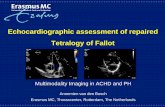 Echocardiographic assessment of repaired Tetralogy of Fallot · Echocardiographic assessment of repaired Tetralogy of Fallot Multimodality Imaging in ACHD and PH Annemien van den