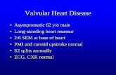 Valvular Heart Disease - wapameeting.com · Valvular Heart Disease Mild to Moderate Aortic Stenosis •Yearly history and physical examination •Focus on symptoms of angina, CHF,