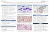 Case report: Systemic mastocytosis with associated clonal ... · Classification of Tumours of Haematopoietic and Lymphoid Tissues places a greater emphasis on molecular testing. •