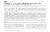 Posterior Vitreous Detachment and the Posterior Hyaloid …€¦ · observed during slit-lamp biomicroscopy examination of patients with posterior vitreous detachment. Materials Under