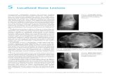 Localized Bone Lesions - thieme.com · 77 Burgener, Kormano, Pudas, Differential Diagnosis in Conventional Radiology (ISBN 9783136561034), © 2007 Georg Thieme Verlag KG Table 5.3