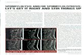 SPONDYLOLYSIS AND/OR SPONDYLOLISTHESIS: LET'S GET IT … · 2018-04-22 · SPONDYLOLYSIS AND/OR SPONDYLOLISTHESIS: LET'S GET IT RIGHT AND STIR THINGS UP by Terry R. Yochum, D.C.,