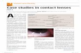 Case studies in contact lenses - Mark Allen Groupassets.markallengroup.com/article-images/image... · contact lenses. In addition, the left eye was also refitted with a spherical
