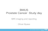 BMUS Prostate Cancer Study day · BMUS Prostate Cancer Study day MRI imaging and reporting Oliver Byass. Objectives • mMRI • Pi-RADS ... MRI sequences T2 (T1) and functional techniques
