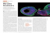 OLOOK BRAIN ANER Brain teasers - Nature Research€¦ · Brain teasers Cerebral organoids are helping researchers to develop fresh approaches to treating brain cancer. A section through