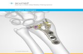 Surgical echnique - Acumed · Acumed® Acu-Loc® 2 Volar Distal Radius Plating System The Acu-Loc 2 Wrist Plating System offers plate families and screw technologies to treat multiple