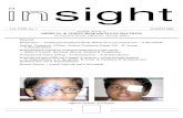 MEDICAL & VISION RESEARCH FOUNDATIONS Files/2005 March INSIGHT.pdfMEDICAL & VISION RESEARCH FOUNDATIONS 18, COLLEGE ROAD, CHENNAI - 600 006, INDIA ... Frosted branch angiitis in renal